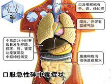 口服急性砷中毒症状